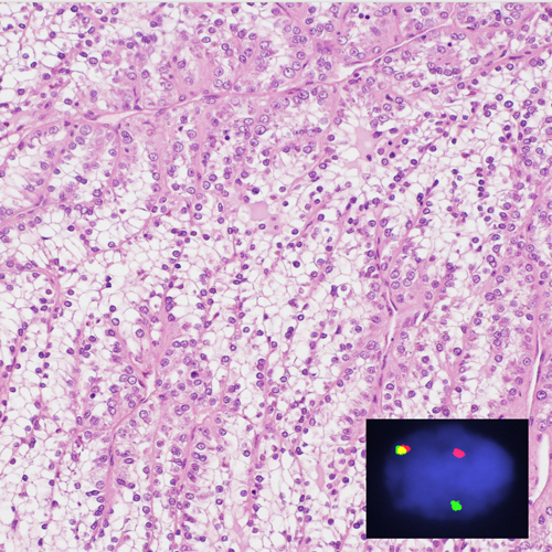 https://www.pathology.med.umich.edu/static/apps/cms/1002/Histopath 500x500.jpg